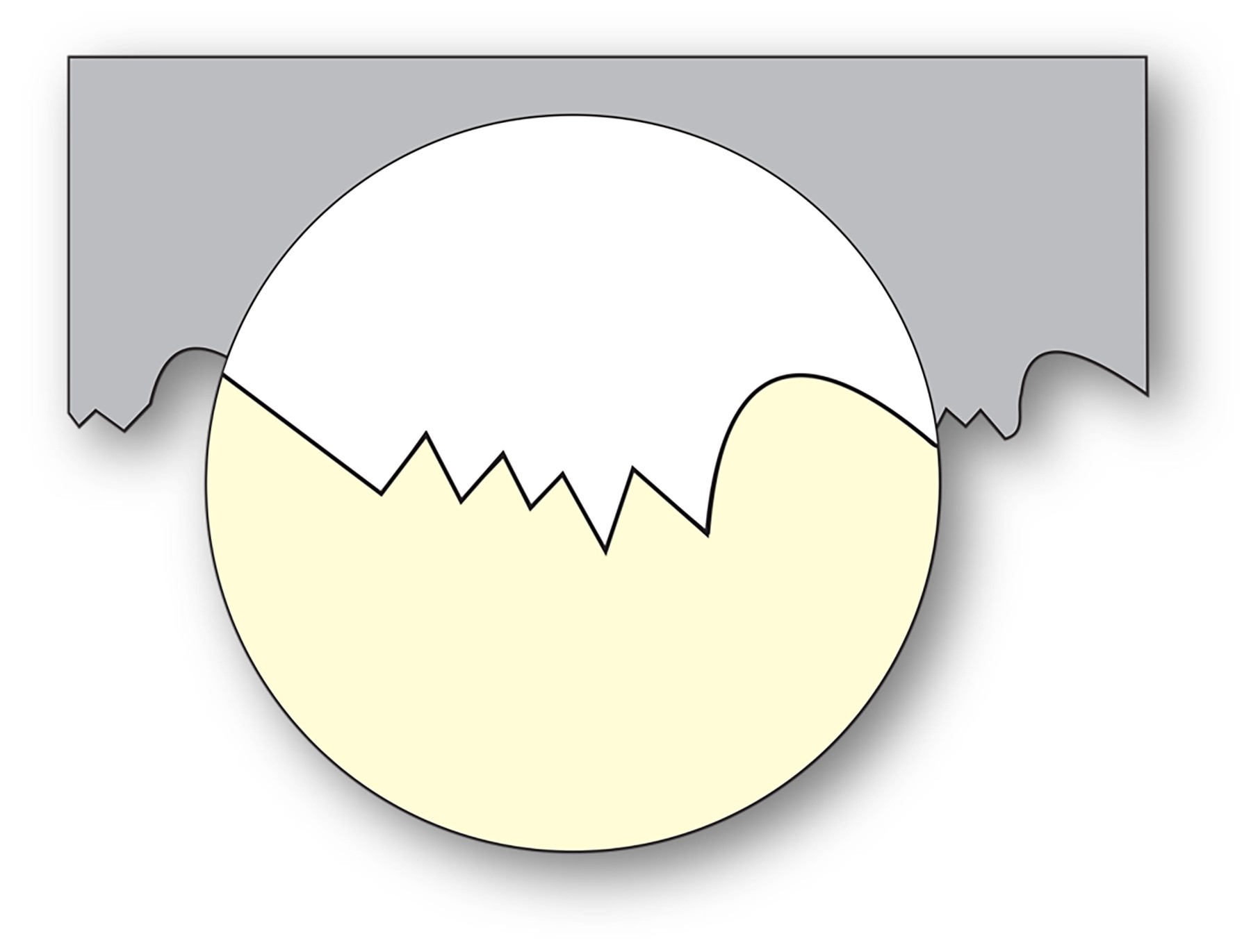 Teeth Stripping illustration – once teeth are damaged, their clearances and angles will be different.